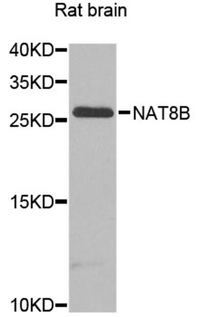 NAT8B Antibody in Western Blot (WB)