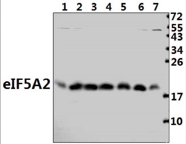 eIF5A2 Antibody in Western Blot (WB)
