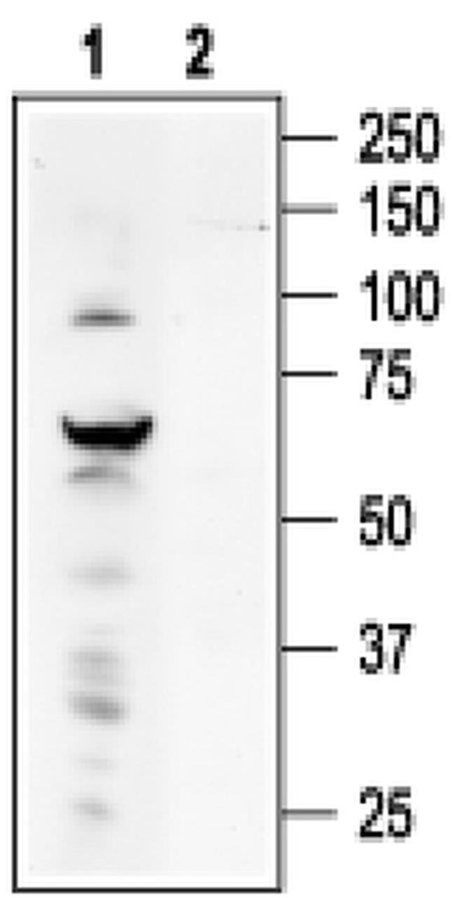 TRPV4 Antibody in Western Blot (WB)