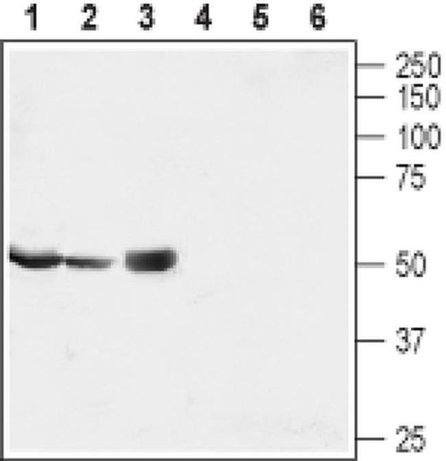 MRS2 Antibody in Western Blot (WB)