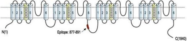 SCN4A Antibody