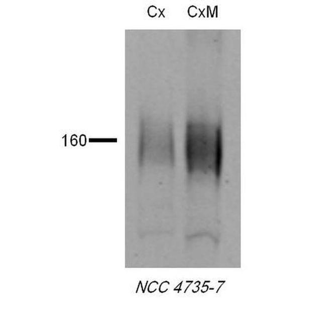 SLC12A3 Antibody in Western Blot (WB)