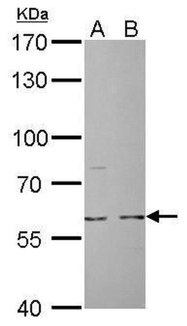 Cdc6 Antibody in Western Blot (WB)