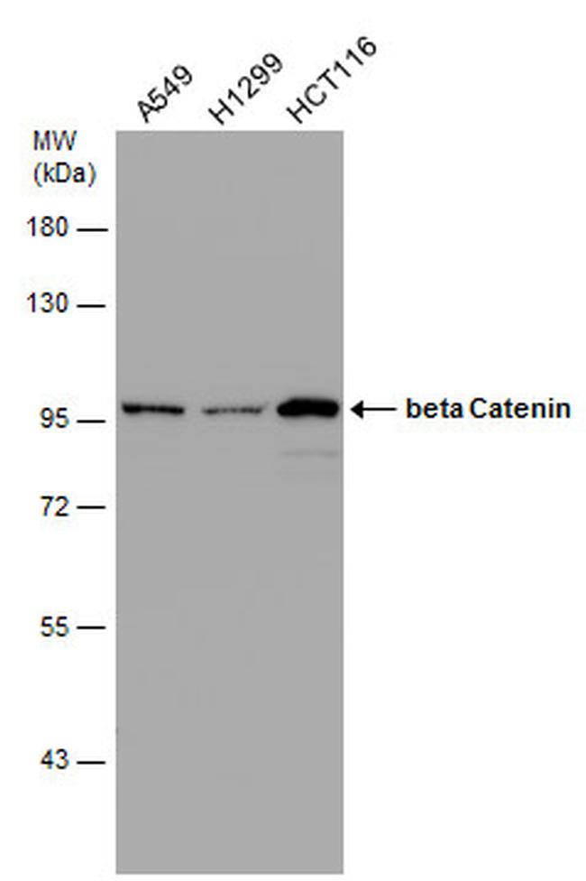 beta Catenin Antibody in Western Blot (WB)
