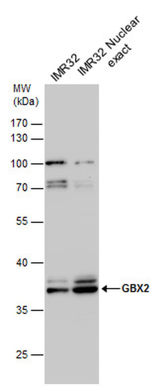 GBX2 Antibody in Western Blot (WB)