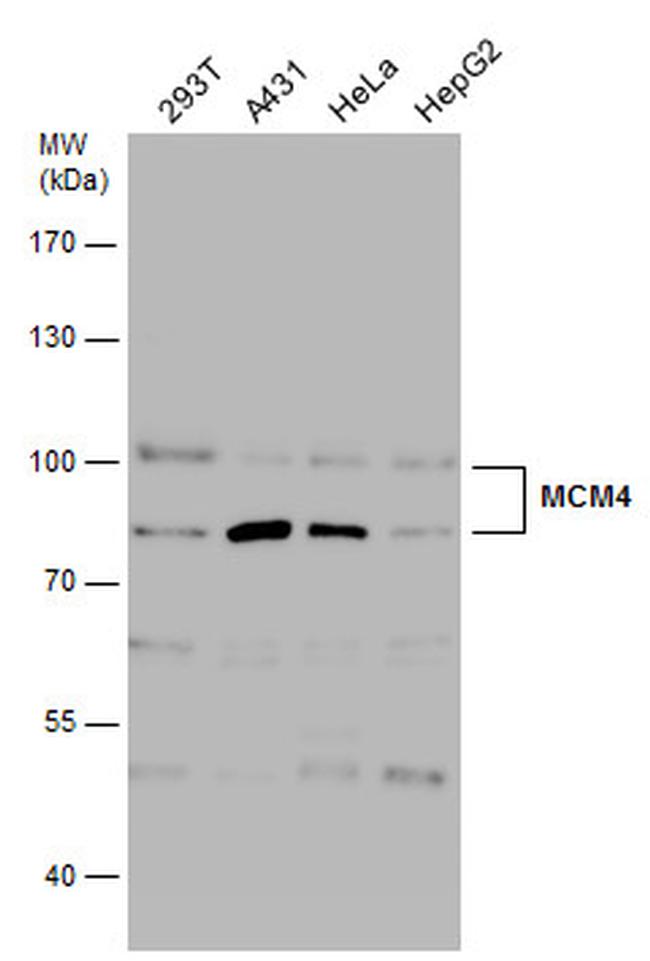 MCM4 Antibody in Western Blot (WB)