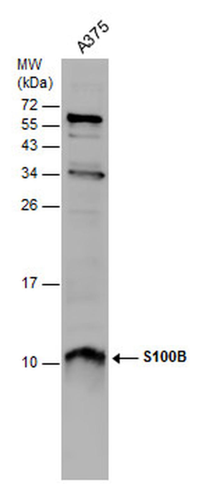 S100B Antibody in Western Blot (WB)