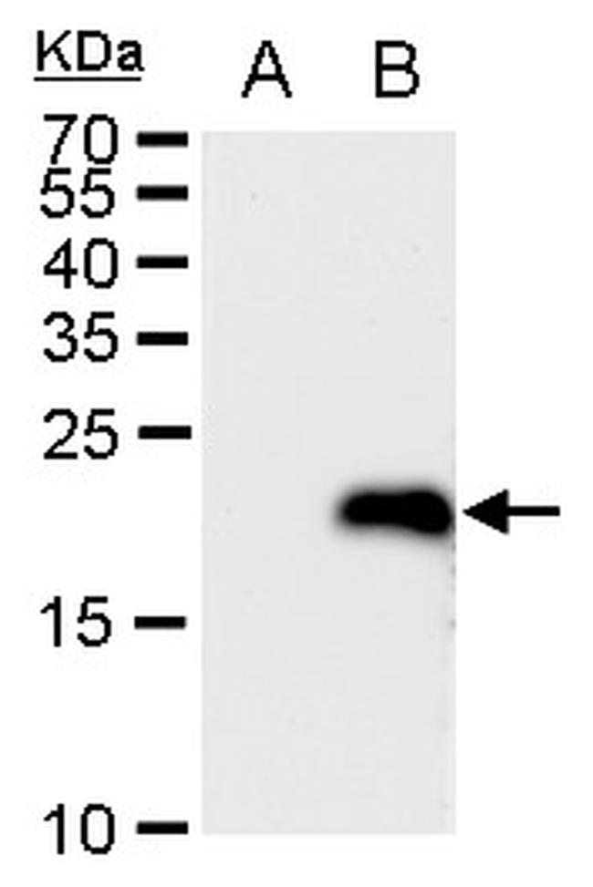 LMO4 Antibody in Western Blot (WB)