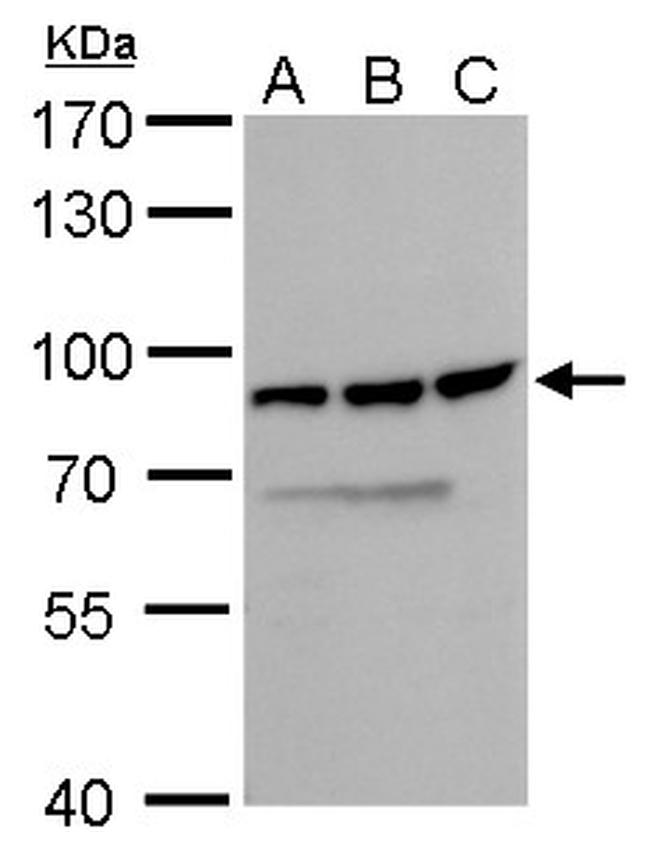 DDX18 Antibody in Western Blot (WB)