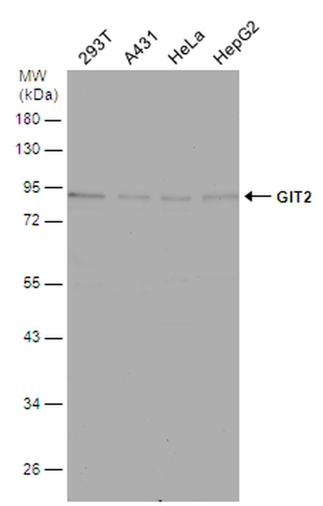 GIT2 Antibody in Western Blot (WB)