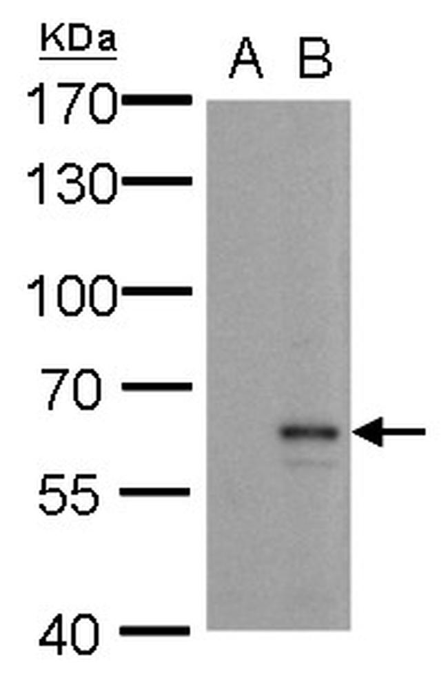 MMP24 Antibody in Western Blot (WB)