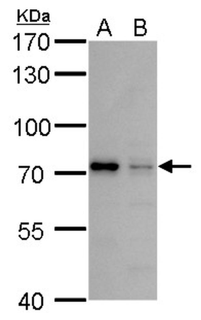 MMP24 Antibody in Western Blot (WB)