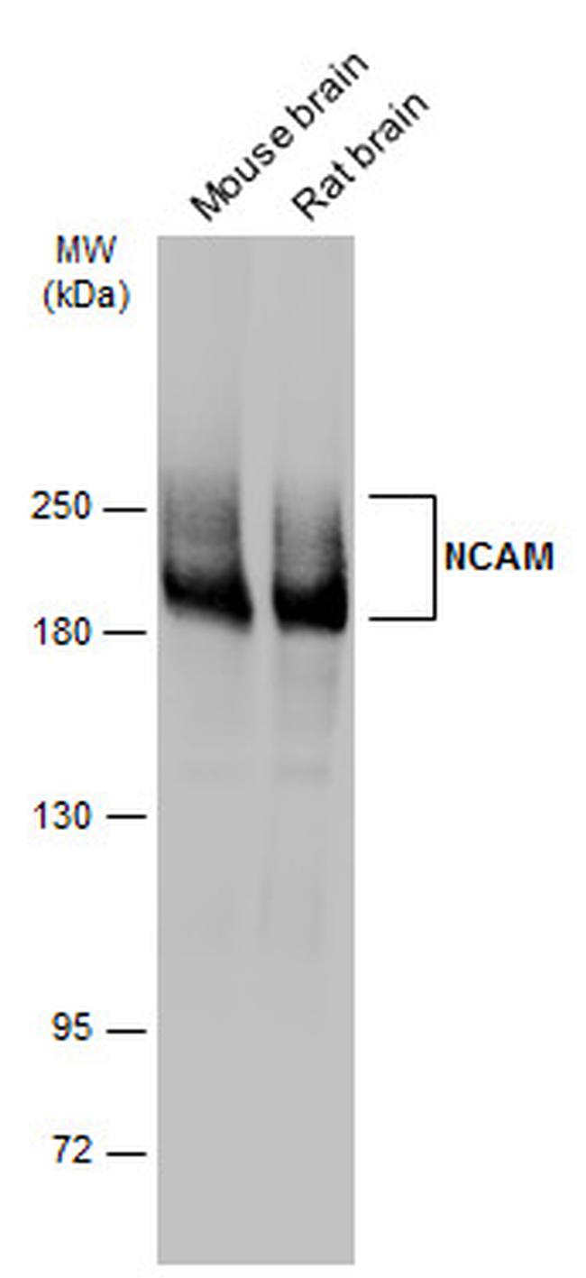 CD56 (NCAM) Antibody in Western Blot (WB)