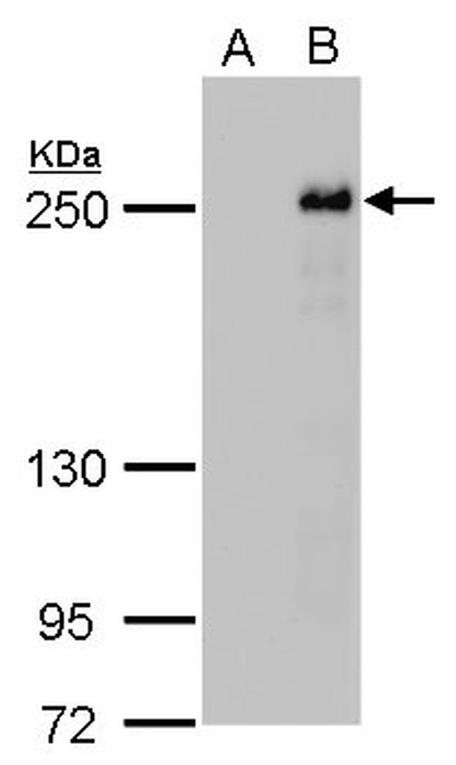 TET2 Antibody in Western Blot (WB)