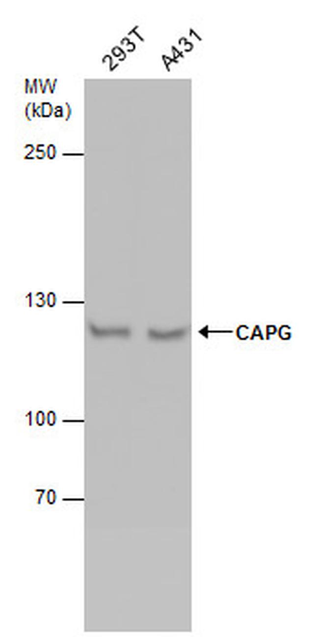 NCAPG Antibody in Western Blot (WB)