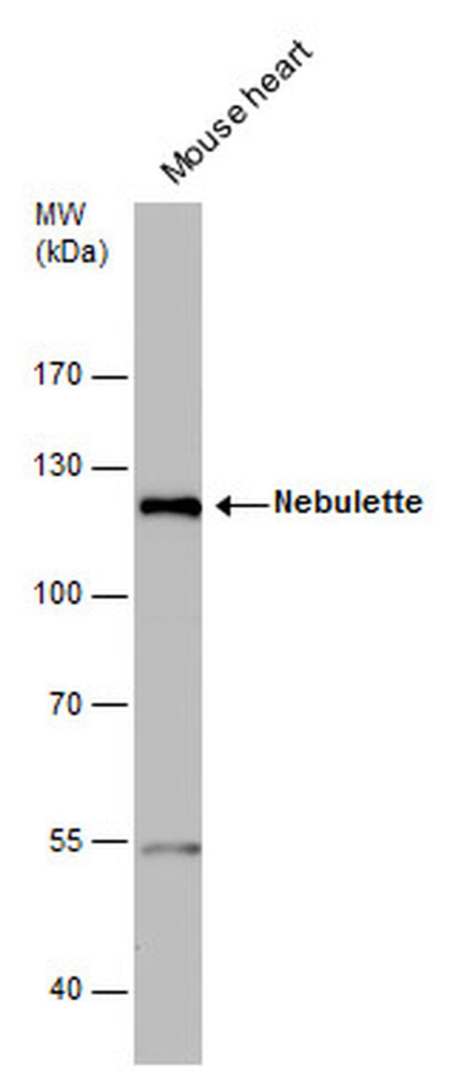 NEBL Antibody in Western Blot (WB)