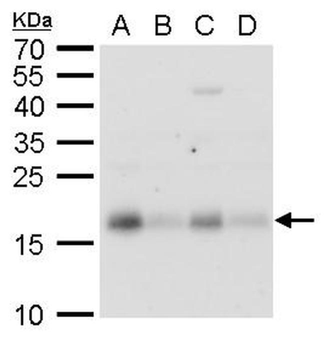 CHAC2 Antibody in Western Blot (WB)