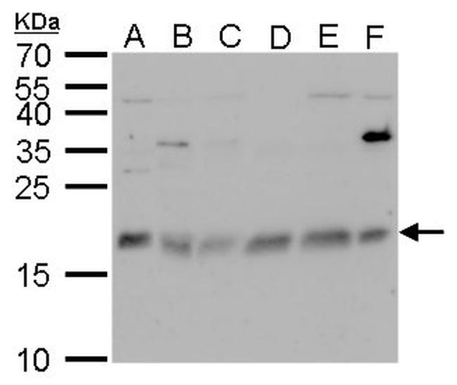 CHAC2 Antibody in Western Blot (WB)