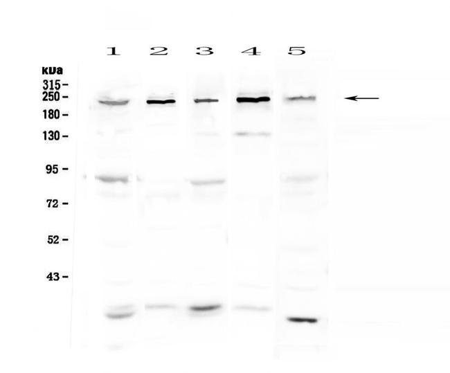 ASXL1 Antibody in Western Blot (WB)