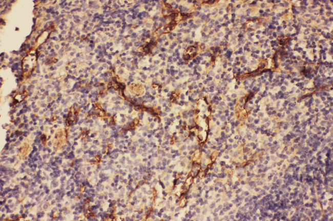 Complement C5a Antibody in Immunohistochemistry (Paraffin) (IHC (P))