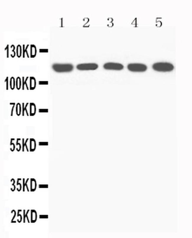 Complement C5a Antibody in Western Blot (WB)