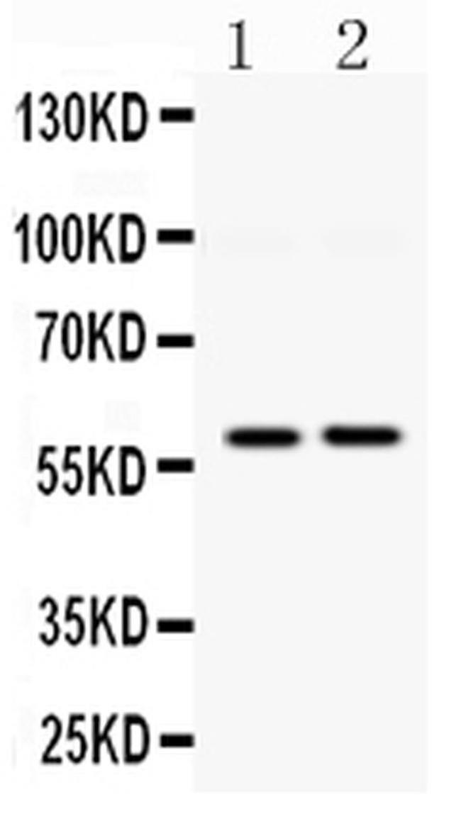 DGAT1 Antibody in Western Blot (WB)