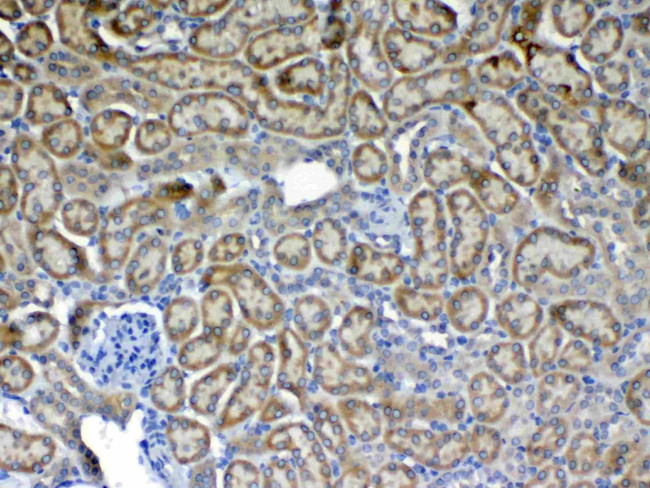 FLT3 (CD135) Antibody in Immunohistochemistry (Paraffin) (IHC (P))