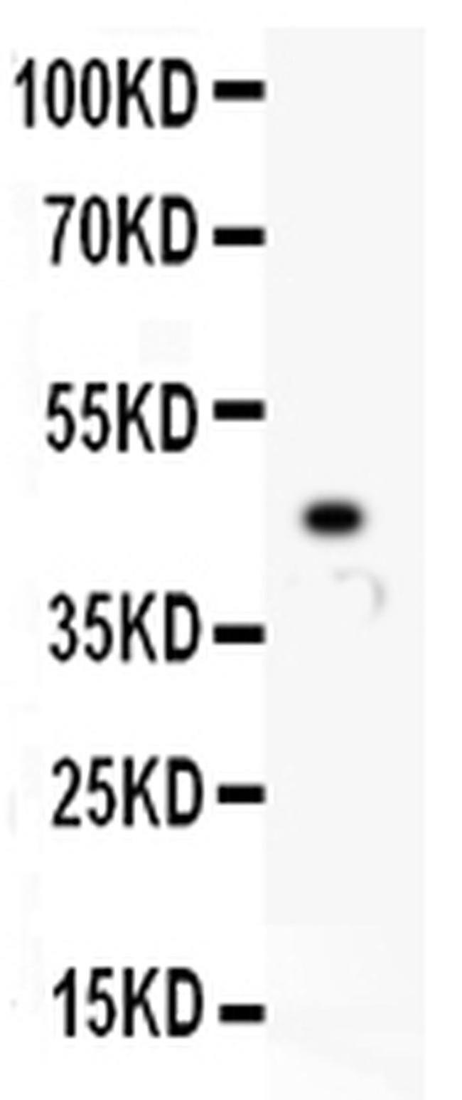 HNF1A Antibody in Western Blot (WB)