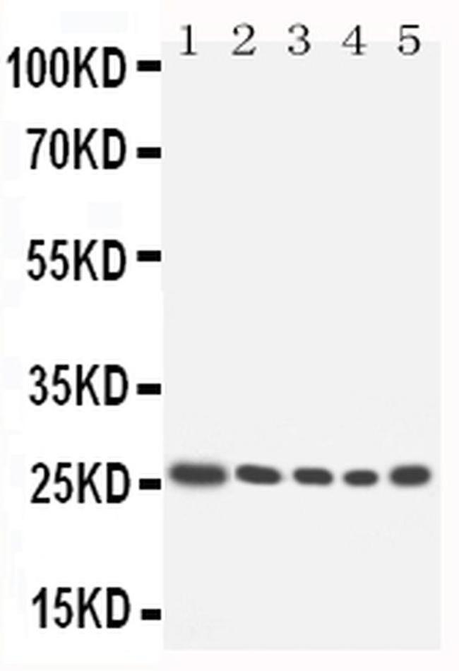HOXA6 Antibody in Western Blot (WB)
