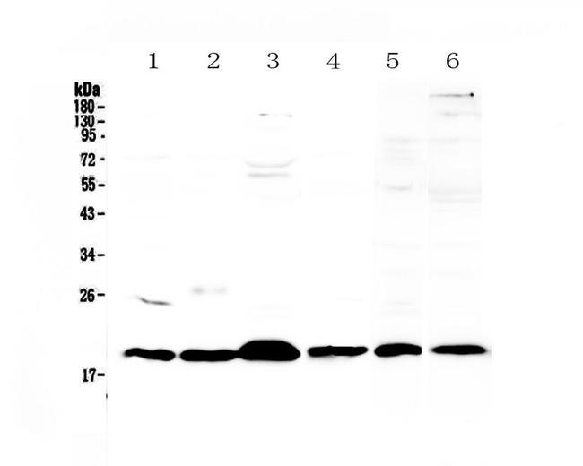 ICOS (CD278) Antibody in Western Blot (WB)