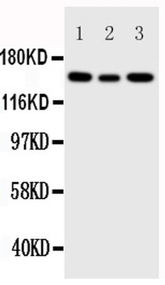 IGF1R (CD221) Antibody in Western Blot (WB)