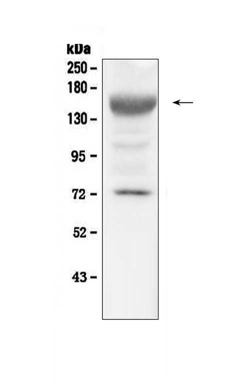 IGF1R (CD221) Antibody in Western Blot (WB)