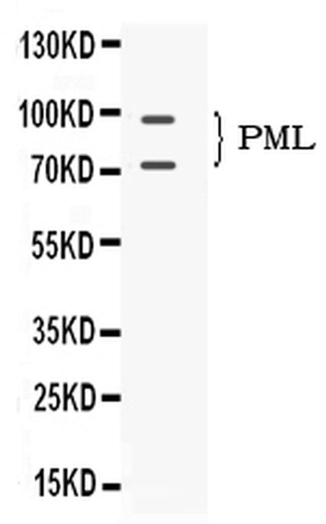 PML Antibody in Western Blot (WB)