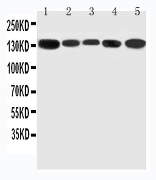 RGS3 Antibody in Western Blot (WB)