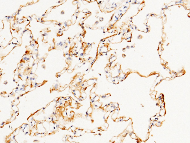 CD55 Antibody in Immunohistochemistry (Paraffin) (IHC (P))