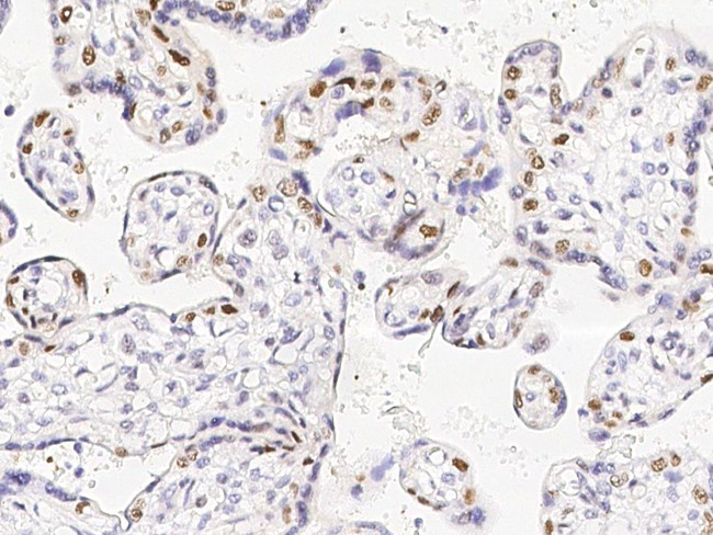 DNMT1 Antibody in Immunohistochemistry (Paraffin) (IHC (P))