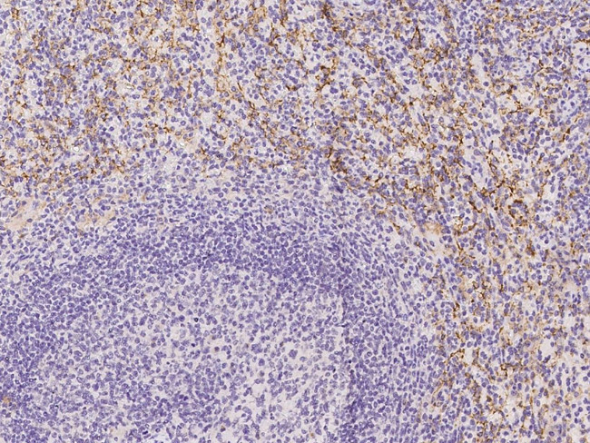 CD16 Antibody in Immunohistochemistry (Paraffin) (IHC (P))