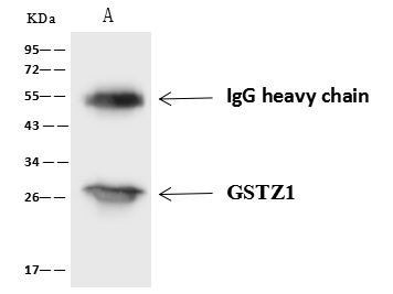 GSTZ1 Antibody in Immunoprecipitation (IP)