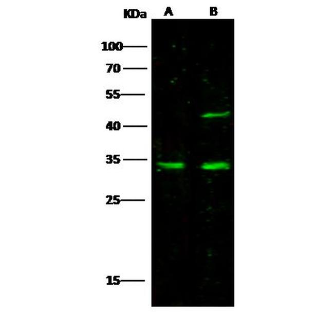 METTL1 Antibody in Western Blot (WB)
