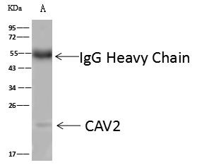 Caveolin 2 Antibody in Immunoprecipitation (IP)