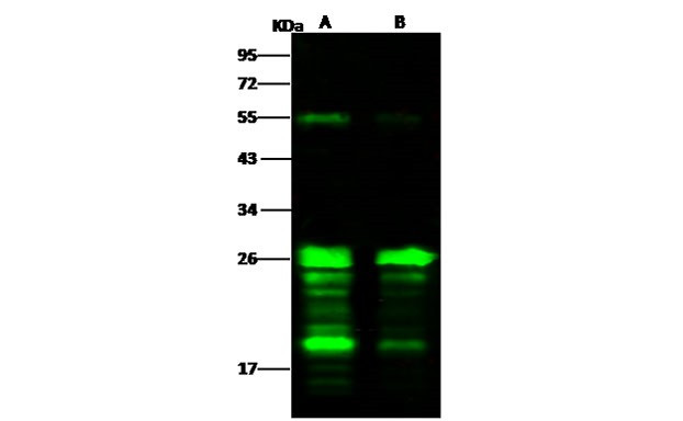 HIV1 p24 (group M, subtype B, strain HXB2) Antibody in Western Blot (WB)