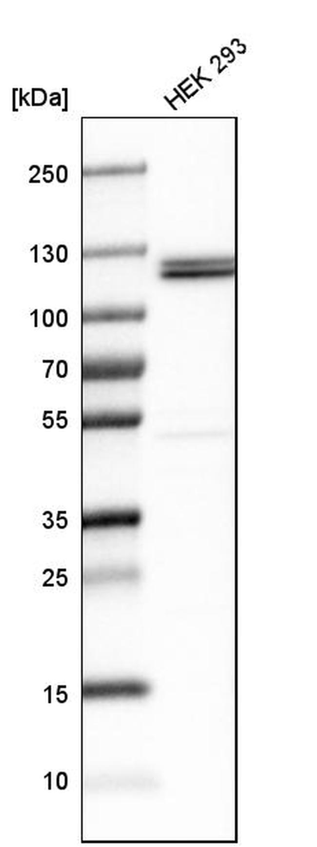 UBE1 Antibody in Western Blot (WB)