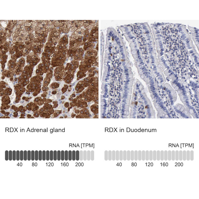 Radixin Antibody in Immunohistochemistry (IHC)
