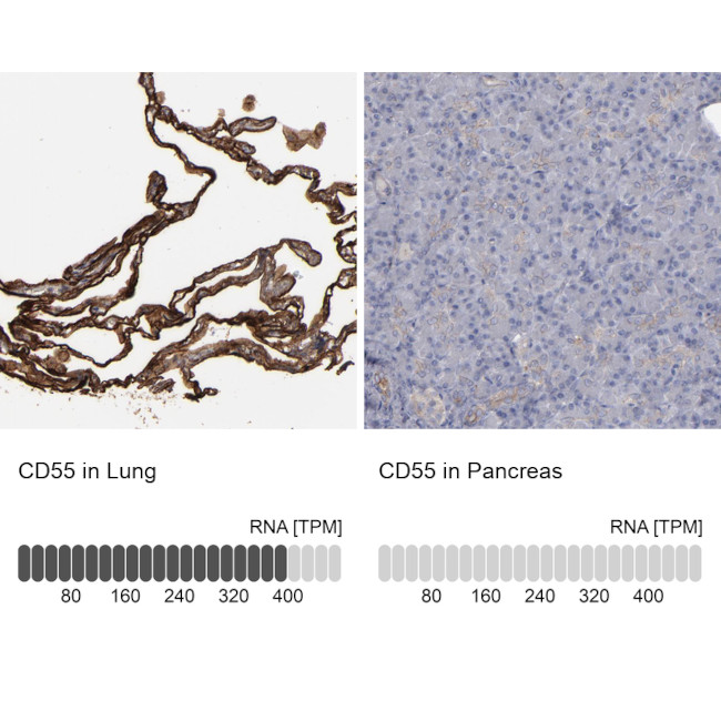 CD55 Antibody in Immunohistochemistry (IHC)