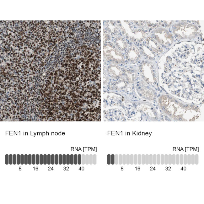 FEN1 Antibody in Immunohistochemistry (IHC)