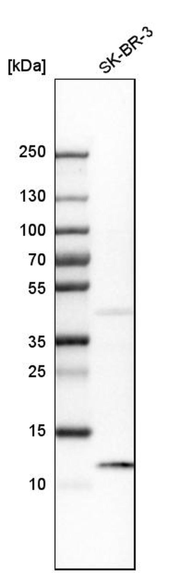 S100A8 Antibody in Western Blot (WB)
