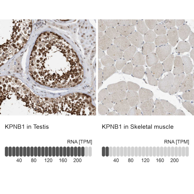 KPNB1 Antibody in Immunohistochemistry (IHC)