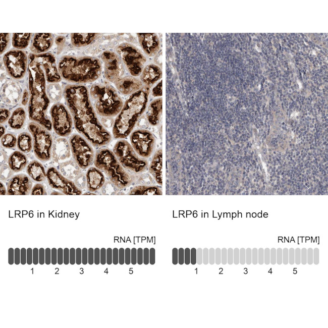 LRP6 Antibody in Immunohistochemistry (IHC)