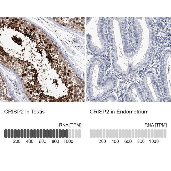 CRISP2 Antibody