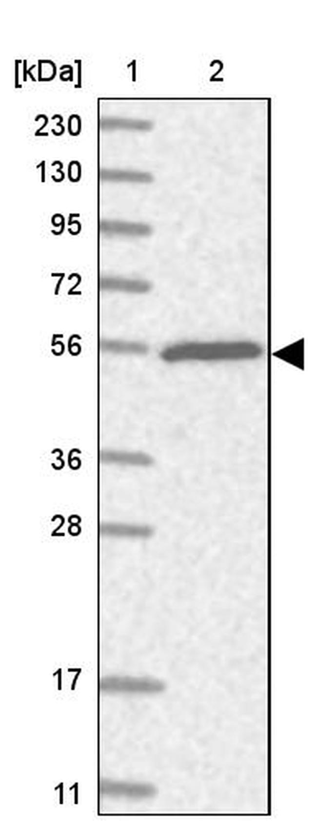 TRIM38 Antibody in Western Blot (WB)